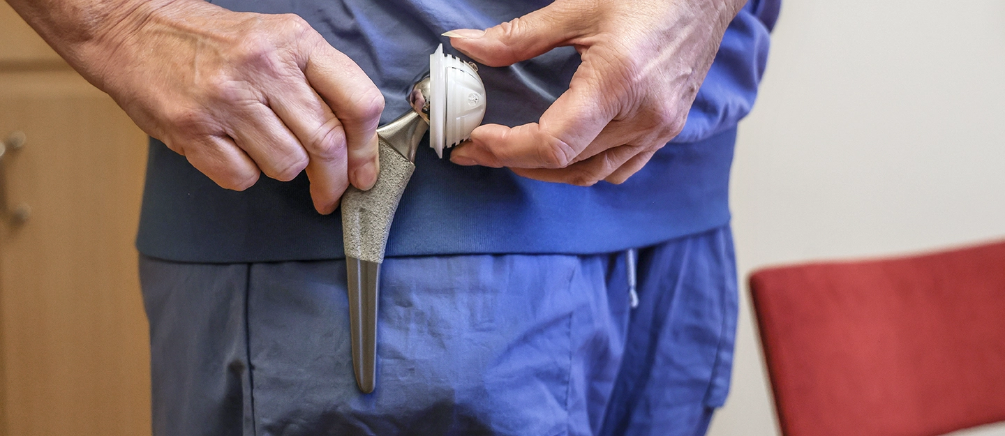 En blåklädd person håller en konstgjord höftled utan sin egen höft.